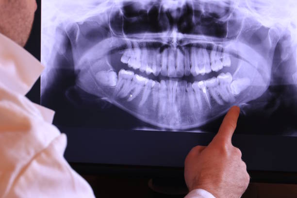 Best Emergency Tooth Extraction in North Muskegon, MI